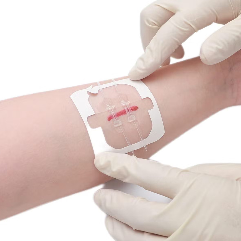 Suture Suture - Image 1